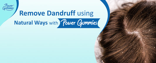 5 Remedies to Remove Dandruff Naturally